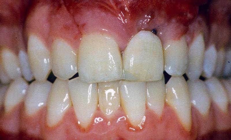 TG2 5220 Fig 3.jpg TG2 5220 Fig 3.jpg