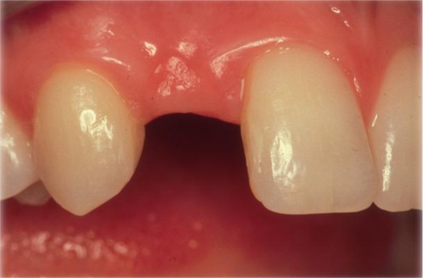 TG2_1120_Fig1.jpg TG2_1120_Fig1.jpg