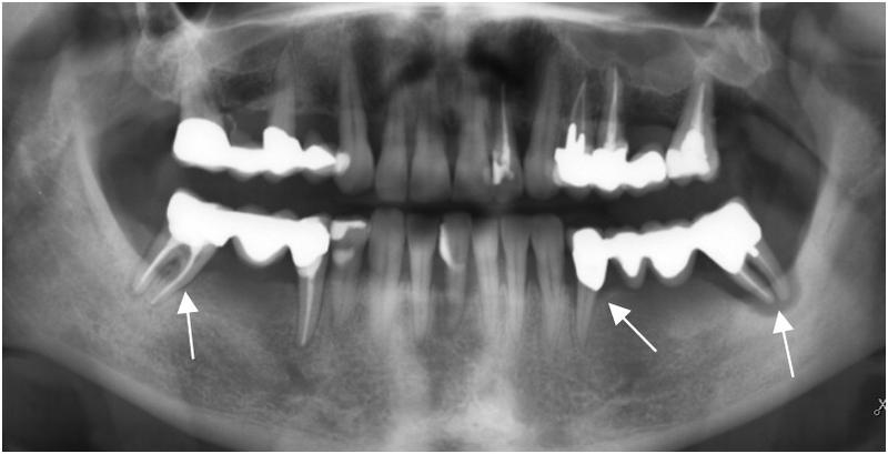 TG2_2160_Fig 3.jpg TG2_2160_Fig 3.jpg