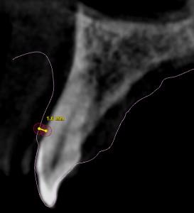 TG2_3140_Fig_7.jpg TG2_3140_Fig_7.jpg