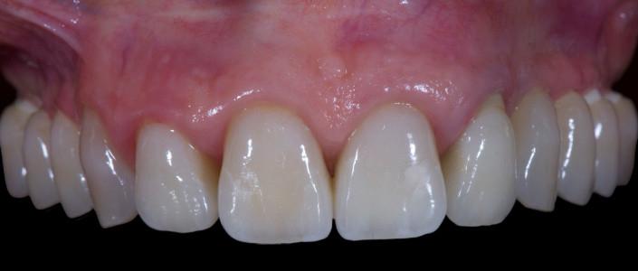 TG2_3210_Figure_4.jpg