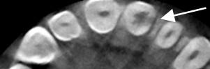 TG2_3410_Fig_1.jpg