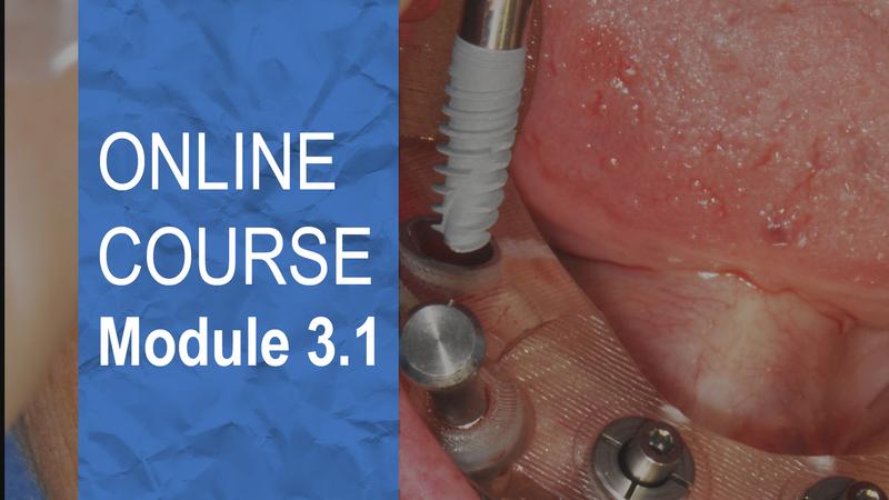 Clinical approaches to the All-on-4® treatment concept Clinical approaches to the All-on-4® treatment concept