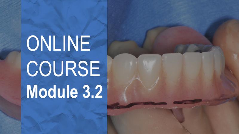 Clinical approaches to the All-on-4® treatment concept Clinical approaches to the All-on-4® treatment concept