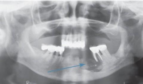 radiograph (Mobile).jpg radiograph (Mobile).jpg