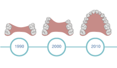 1150-Existing-prosthesis.png