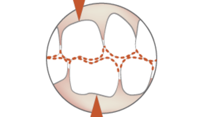 1210-Occlusion.png