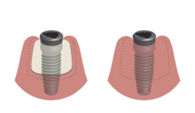 2380-healed-vs-fresh.png