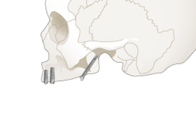 2630.png