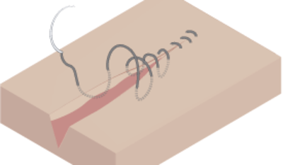 3058-wound-closure.png
