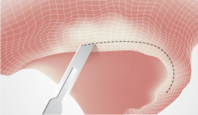 3299-thumb-surgicalprotocols_max.png