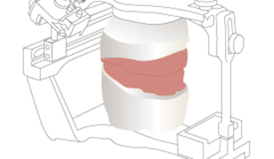 3570-Complete-denture-maxillo-mandibular-relations.png