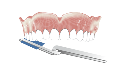 3634-Implant-overdenture-placement.png