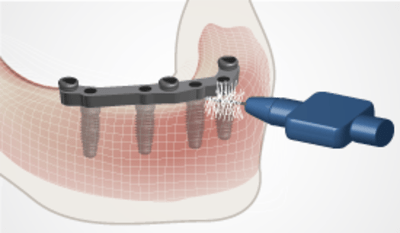 4230-thumb-Oral-hygiene-instructions.png