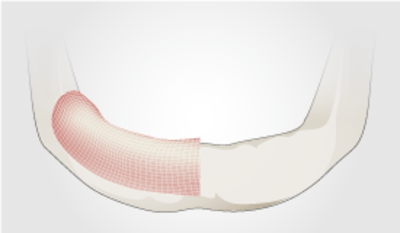 4320-thumb-soft-and-hard-tissue.png