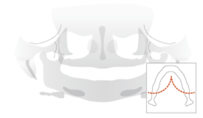 4470-Radiological-control.png
