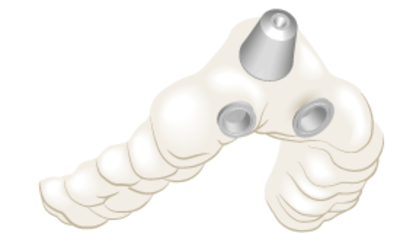 TG2_4140_thumb_Guided-protocol,-introduction.png
