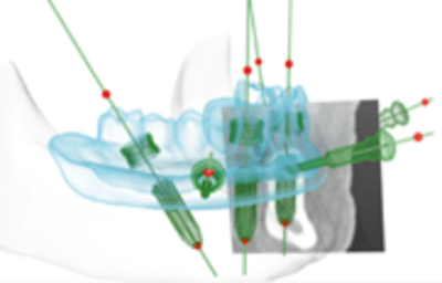 thumb 2393_placeholder.png